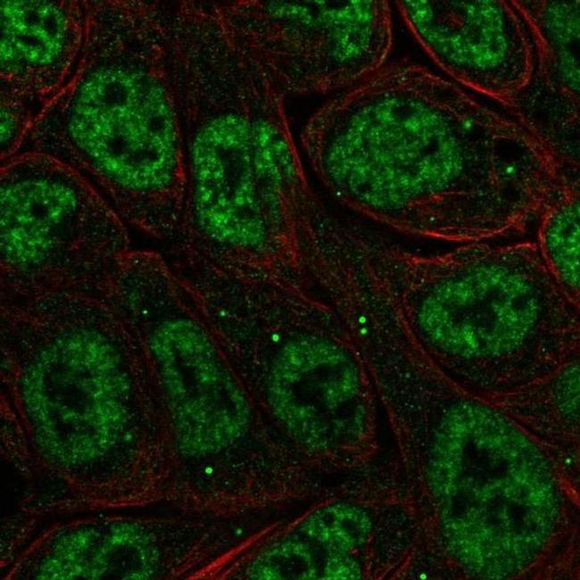 IkB zeta Antibody in Immunocytochemistry (ICC/IF)