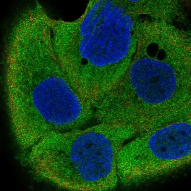 IRF6 Antibody in Immunocytochemistry (ICC/IF)