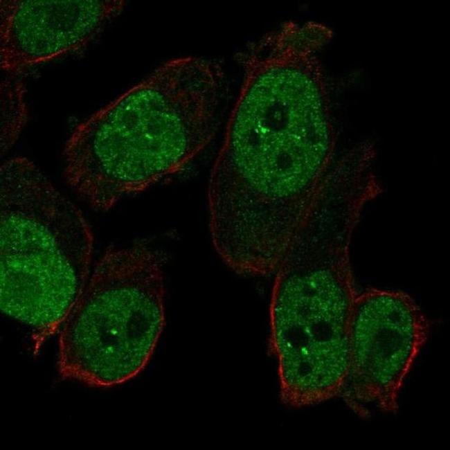 RAPGEF5 Antibody in Immunocytochemistry (ICC/IF)