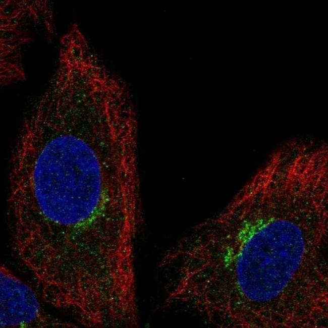 SLC6A16 Antibody in Immunocytochemistry (ICC/IF)