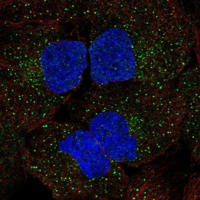 WNK3 Antibody in Immunocytochemistry (ICC/IF)