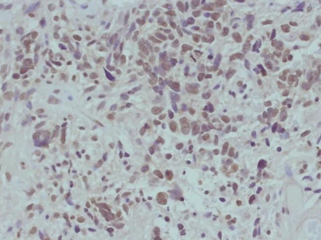 Phospho-beta Catenin (Ser715) Antibody in Immunohistochemistry (Paraffin) (IHC (P))