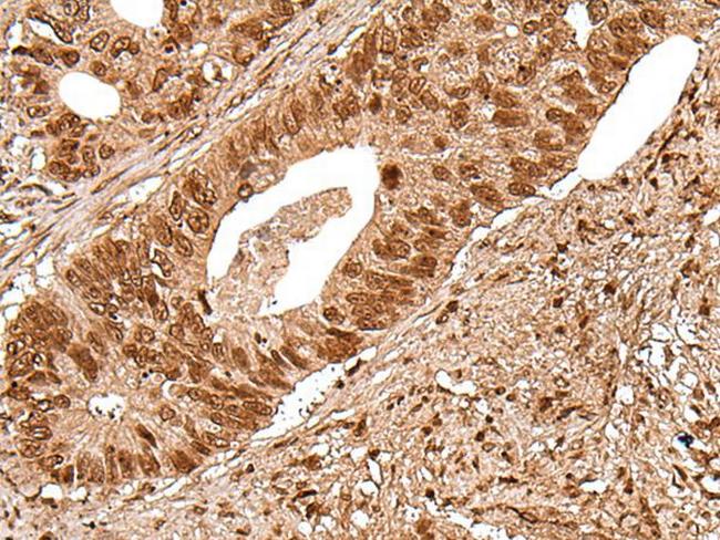 DEDD2 Antibody in Immunohistochemistry (Paraffin) (IHC (P))