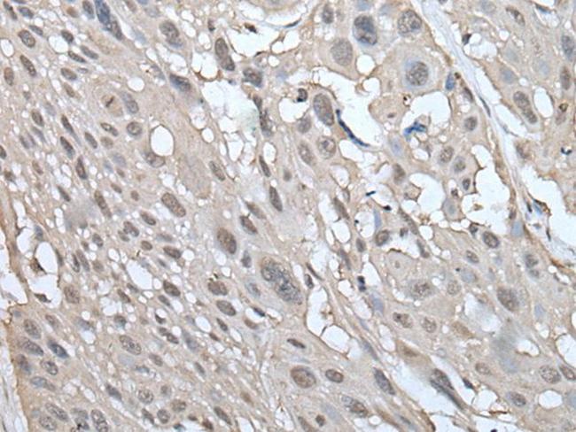 UBE2W Antibody in Immunohistochemistry (Paraffin) (IHC (P))