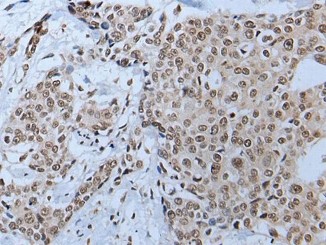 HOXD10 Antibody in Immunohistochemistry (Paraffin) (IHC (P))