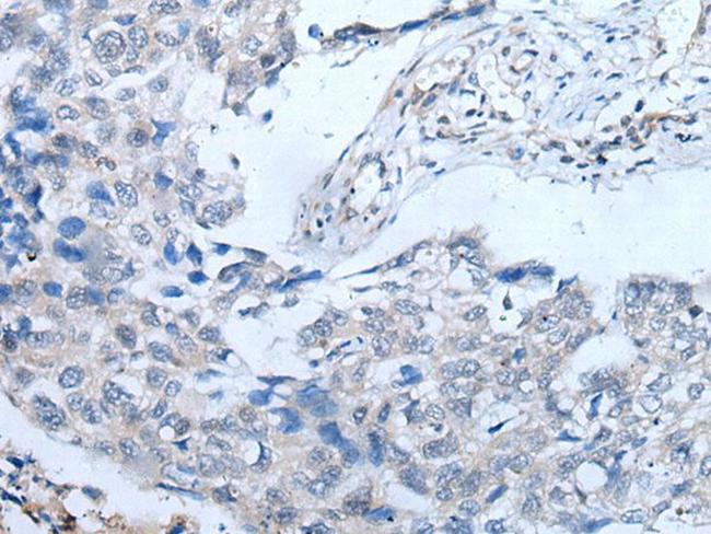 UBR4 Antibody in Immunohistochemistry (Paraffin) (IHC (P))