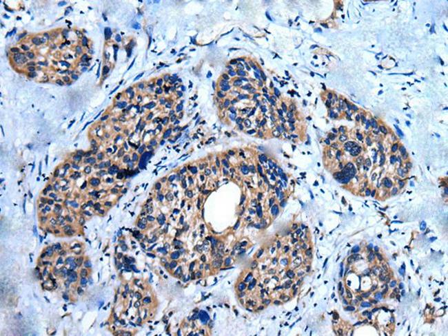 UNC5A Antibody in Immunohistochemistry (Paraffin) (IHC (P))