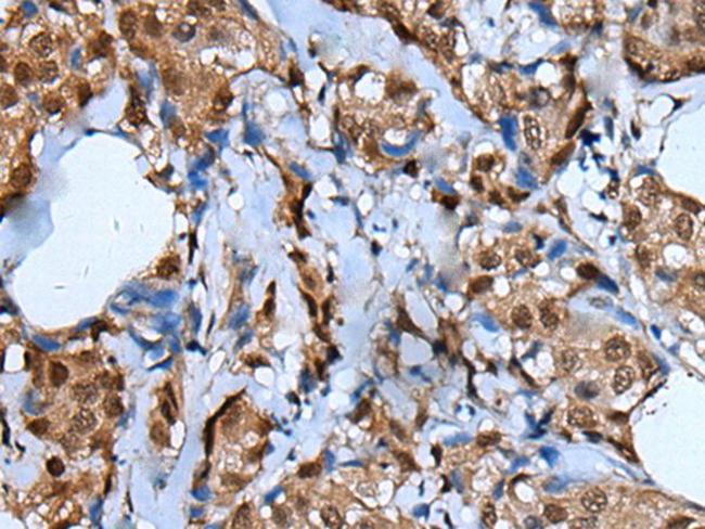 UNCX Antibody in Immunohistochemistry (Paraffin) (IHC (P))