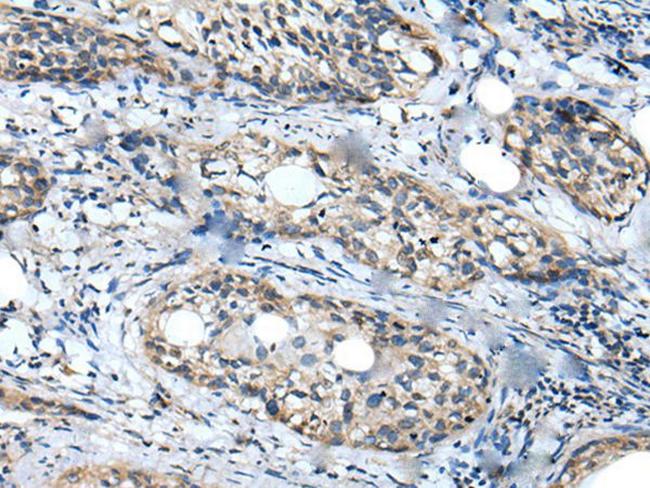 WDFY2 Antibody in Immunohistochemistry (Paraffin) (IHC (P))