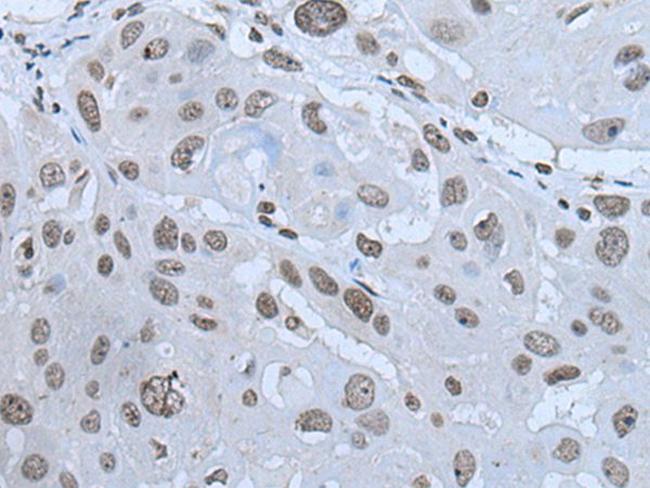 HAND1 Antibody in Immunohistochemistry (Paraffin) (IHC (P))