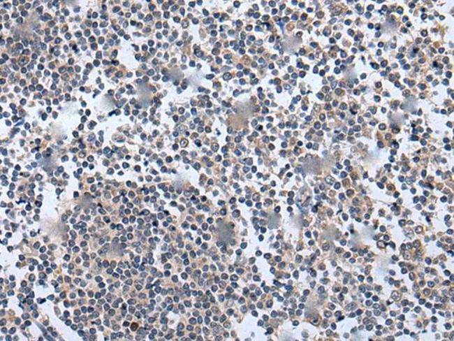 WNT5A Antibody in Immunohistochemistry (Paraffin) (IHC (P))