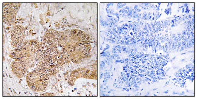 LUC7L2 Antibody in Immunohistochemistry (Paraffin) (IHC (P))