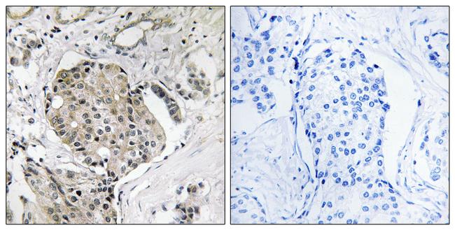 USP40 Antibody in Immunohistochemistry (Paraffin) (IHC (P))