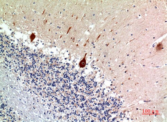 Nodal Antibody in Immunohistochemistry (Paraffin) (IHC (P))