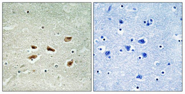 p39 Antibody in Immunohistochemistry (Paraffin) (IHC (P))