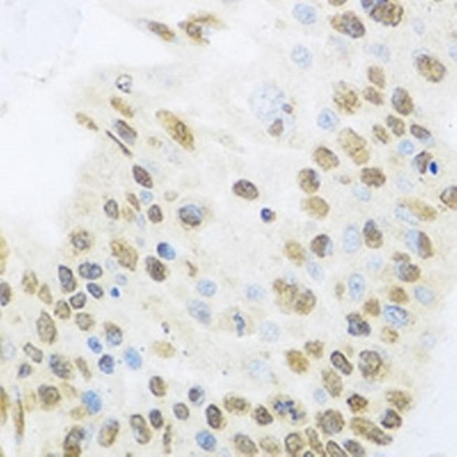 ZBTB17 Antibody in Immunohistochemistry (Paraffin) (IHC (P))