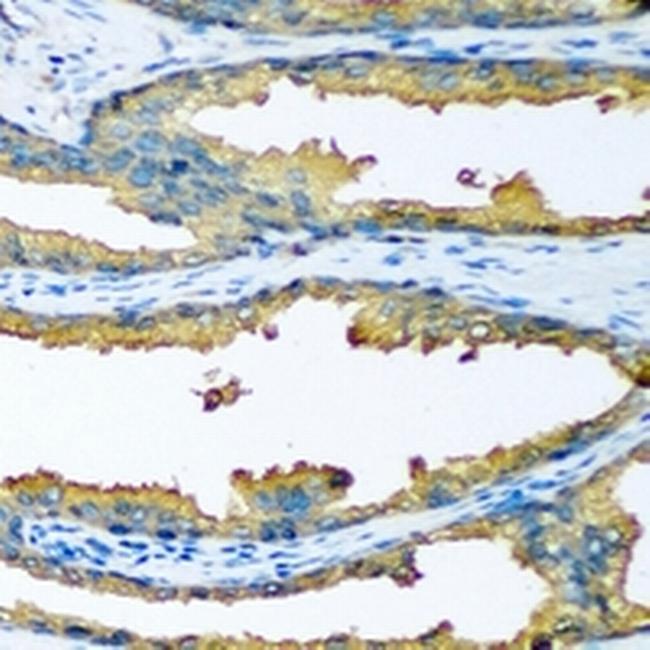 CYP46A1 Antibody in Immunohistochemistry (Paraffin) (IHC (P))