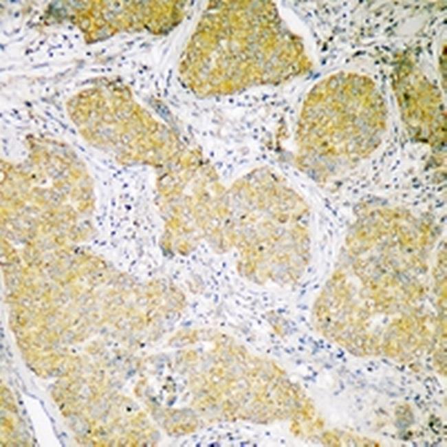 MCU Antibody in Immunohistochemistry (Paraffin) (IHC (P))