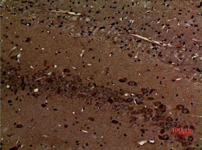 MYO6 Antibody in Immunohistochemistry (Paraffin) (IHC (P))