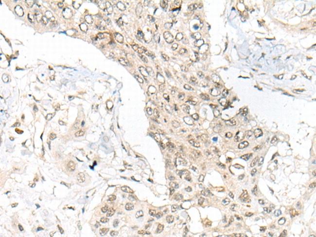 ASXL1 Antibody in Immunohistochemistry (Paraffin) (IHC (P))