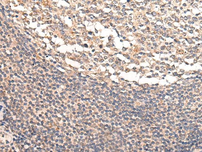 CAPS1 Antibody in Immunohistochemistry (Paraffin) (IHC (P))