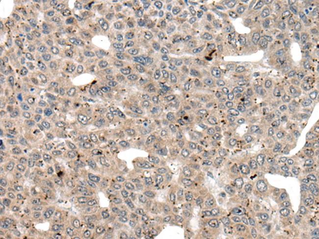 IFFO2 Antibody in Immunohistochemistry (Paraffin) (IHC (P))