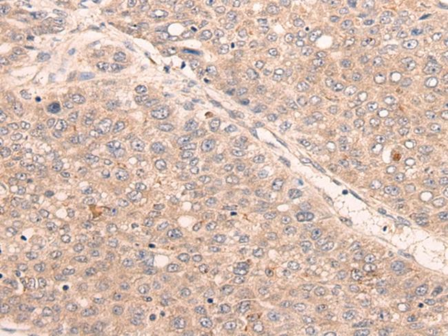 KDF1 Antibody in Immunohistochemistry (Paraffin) (IHC (P))