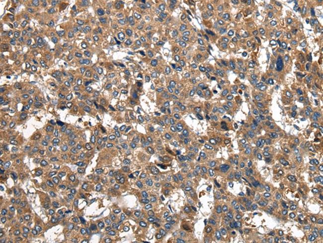 PIWIL2 Antibody in Immunohistochemistry (Paraffin) (IHC (P))