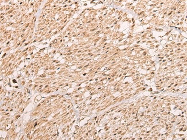 WBP5 Antibody in Immunohistochemistry (Paraffin) (IHC (P))