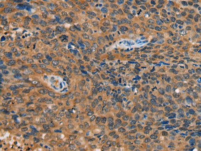 YTHDF1 Antibody in Immunohistochemistry (Paraffin) (IHC (P))