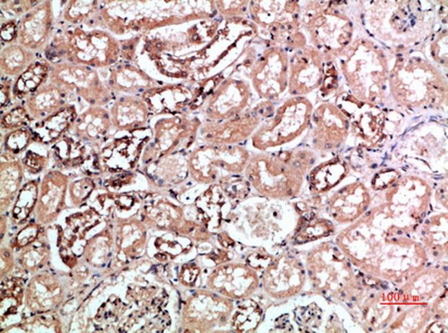 KIR2DL5A/KIR2DL5B Antibody in Immunohistochemistry (Paraffin) (IHC (P))