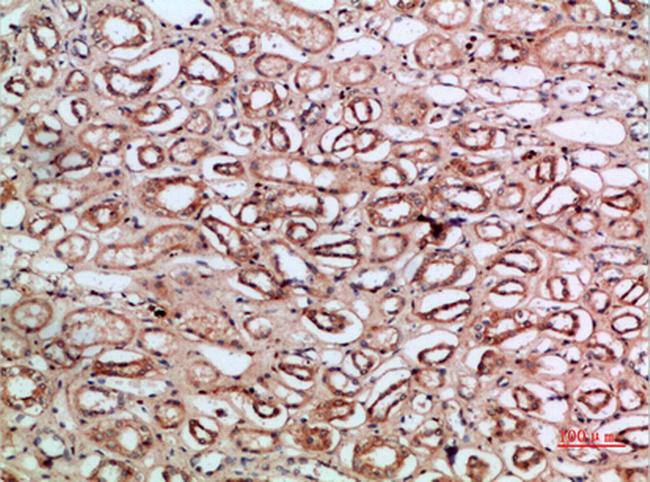 Tetranectin Antibody in Immunohistochemistry (Paraffin) (IHC (P))