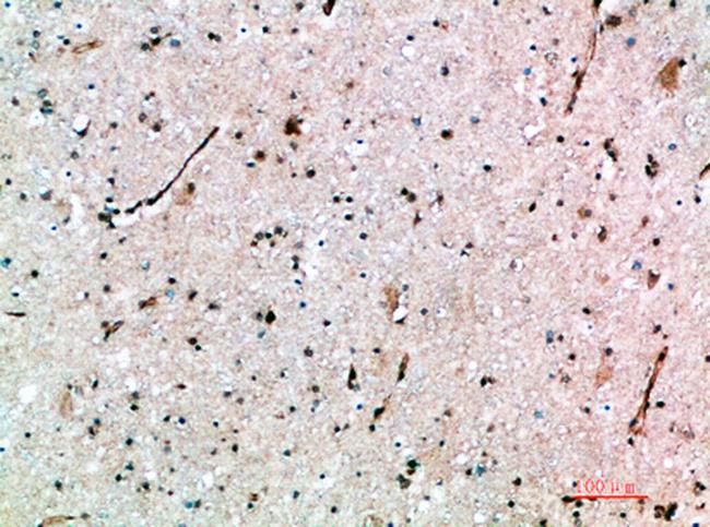 AVPR1B Antibody in Immunohistochemistry (Paraffin) (IHC (P))