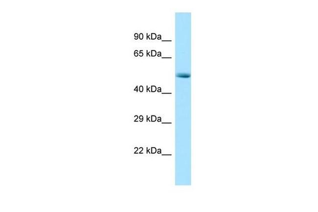 CDK8 Antibody in Western Blot (WB)