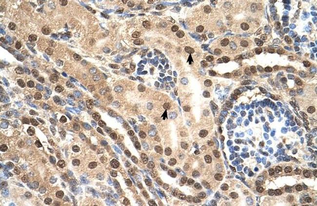 TCEB2 Antibody in Immunohistochemistry (IHC)