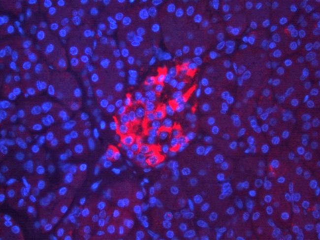 RIP3 Antibody in Immunohistochemistry (IHC)