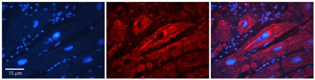 SLC26A3 Antibody in Immunohistochemistry (Paraffin) (IHC (P))