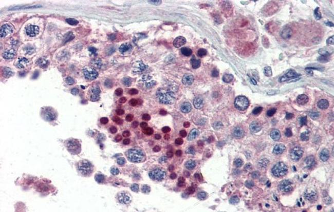 NR0B1 Antibody in Immunohistochemistry (IHC)