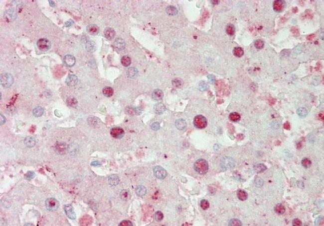 ATOH1 Antibody in Immunohistochemistry (IHC)