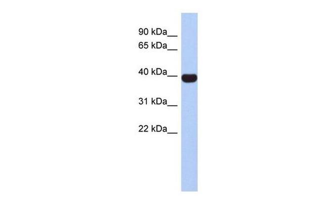 NEUROD4 Antibody in Western Blot (WB)