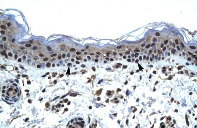 IKZF5 Antibody in Immunohistochemistry (IHC)