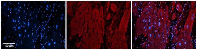 ZFP36L1 Antibody in Immunohistochemistry (Paraffin) (IHC (P))