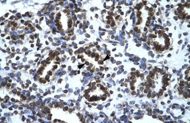 HIC5 Antibody in Immunohistochemistry (IHC)