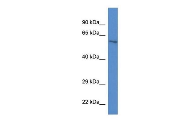 ZKSCAN1 Antibody in Western Blot (WB)