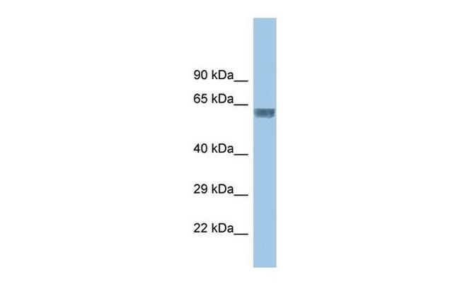 GLRA3 Antibody in Western Blot (WB)