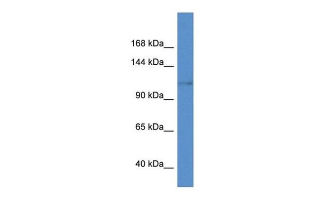 KCNH8 Antibody in Western Blot (WB)