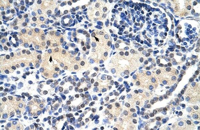 ZNF271 Antibody in Immunohistochemistry (IHC)