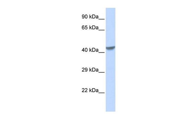 ZNF271 Antibody in Western Blot (WB)