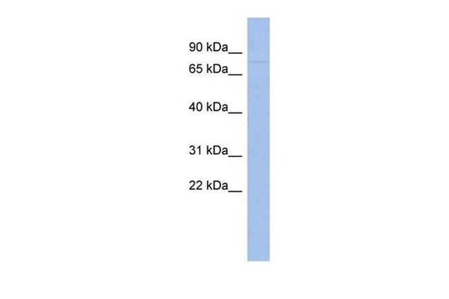 ZNF233 Antibody in Western Blot (WB)