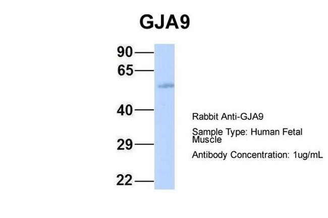 GJA9 Antibody in Western Blot (WB)